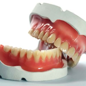 Riparazione Protesi Dentarie Roma