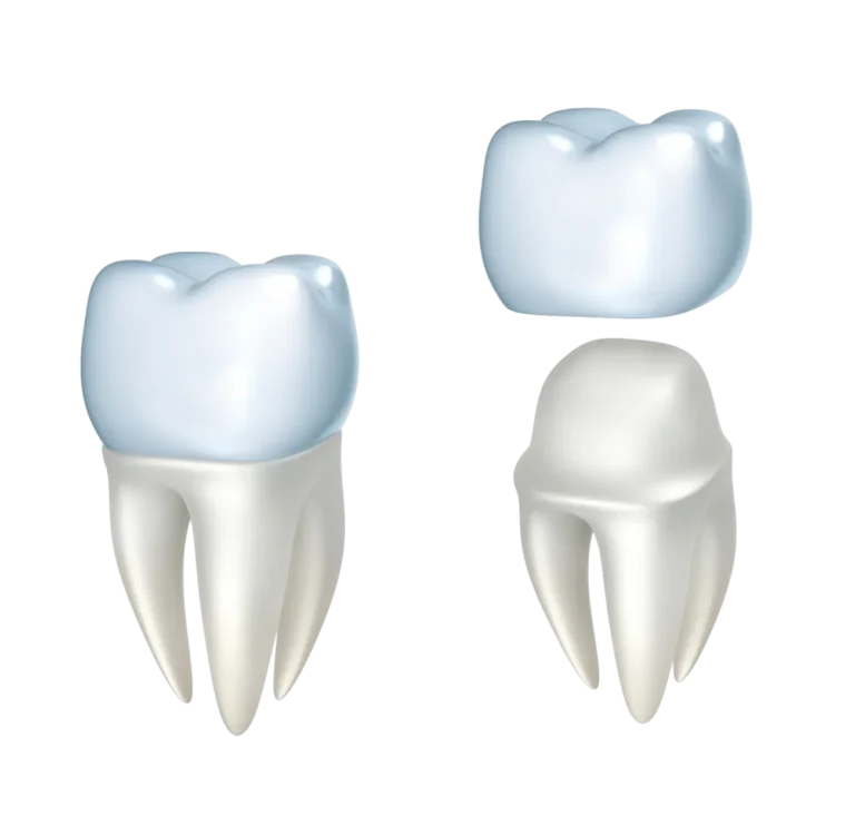 Corona Dentale