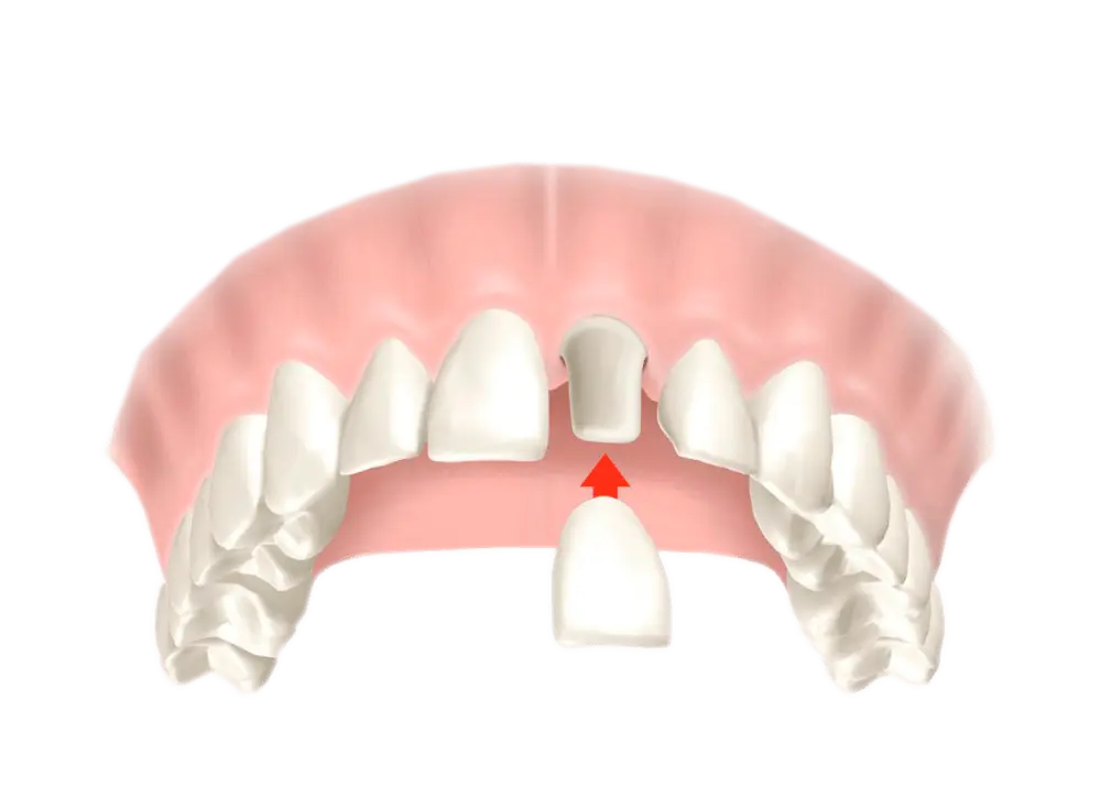 Corone Dentali Roma Biodental